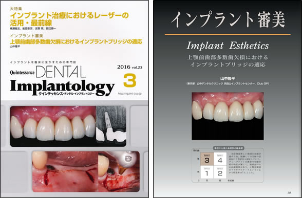 Quintessence DENTAL Implantology vol.23 2016年3月号