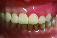 Gum disease / Preventative dental care